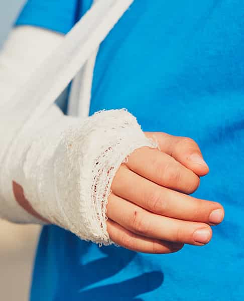 broken arm in a cast